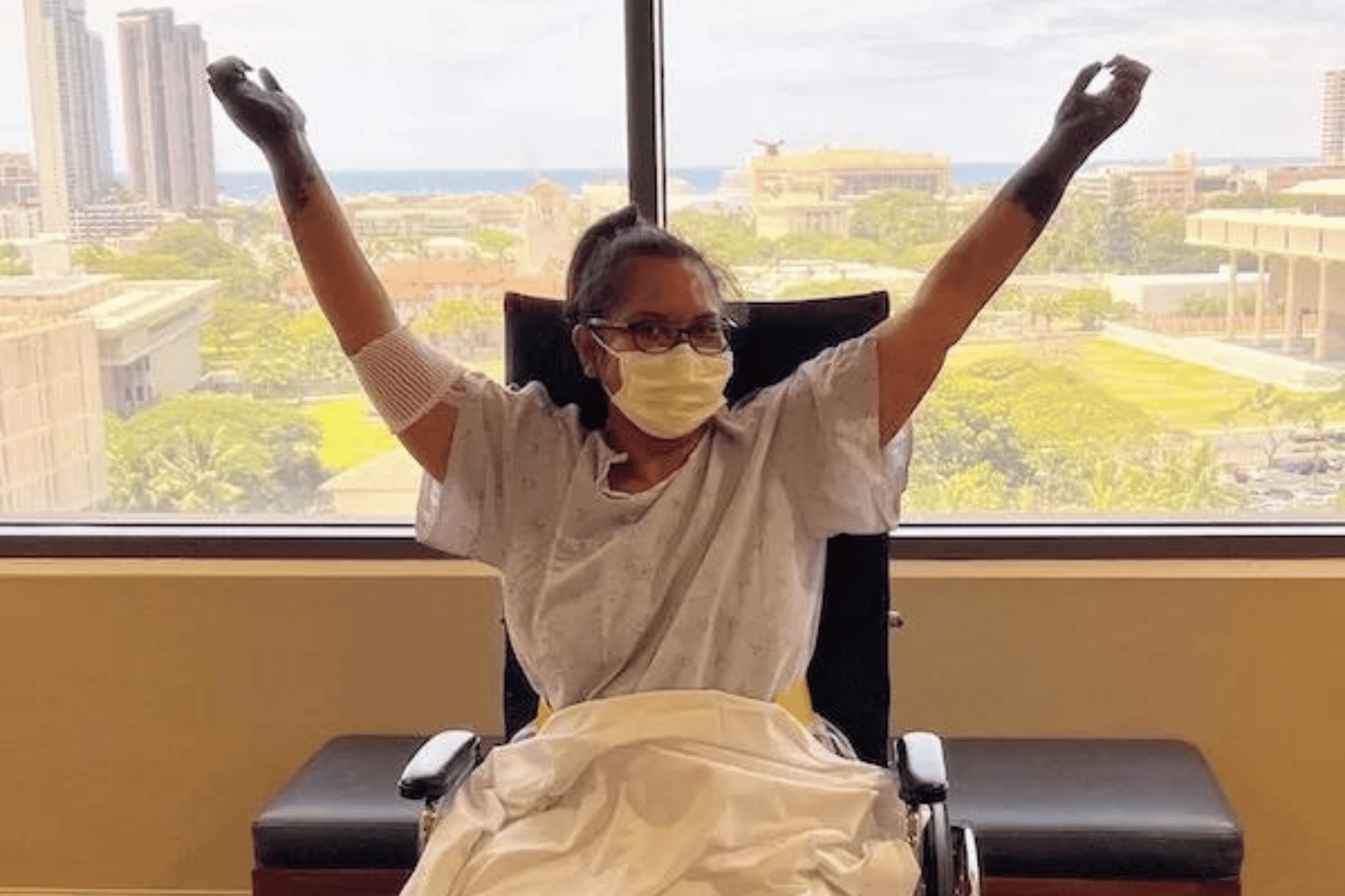 Lauren Washington after surgery wearing a mask with her hands held up